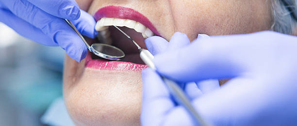 Best Emergency Dentist for Lost Fillings or Crowns in North Chicago, IL